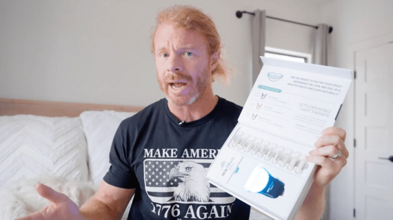 JP Sears Real White Teeth Whitening